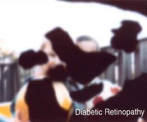 diabetic-retinopathy-vision