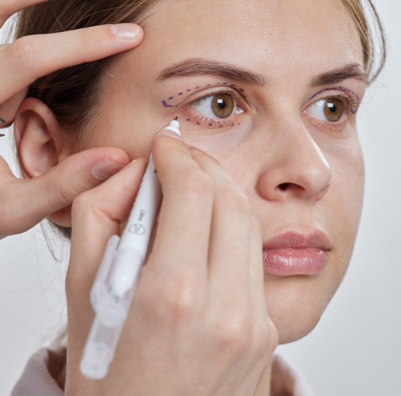 Female Patient Preparing For Eye Plastic Surgery