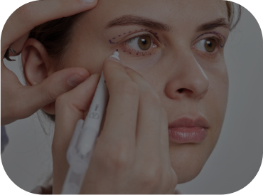 Female Patient Receiving Cosmetic Eye Surgery